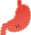 胃潰胃・十二指腸潰瘍瘍